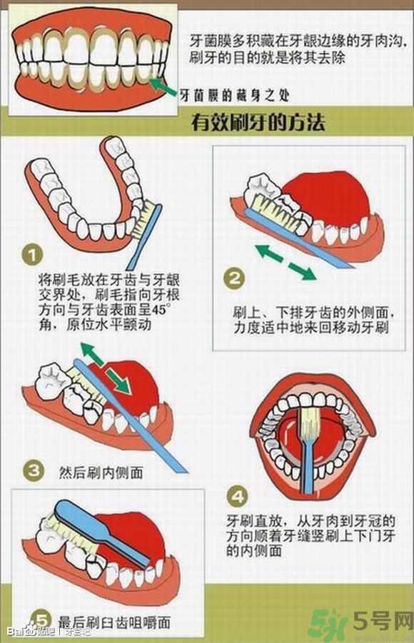 18歲還能戴牙套嗎？戴牙套真的能瘦臉改變臉型嗎？