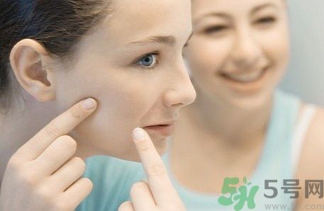 臉上有痘印怎么去除？去除痘印的小妙方？