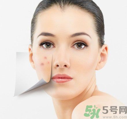臉上有斑怎么去除？祛斑的小偏方有哪些？