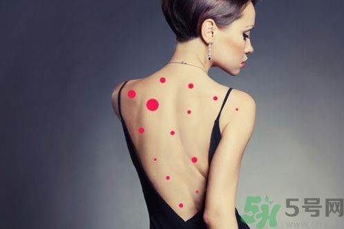 背上為什么會(huì)長(zhǎng)痘痘？長(zhǎng)痘痘怎么辦？