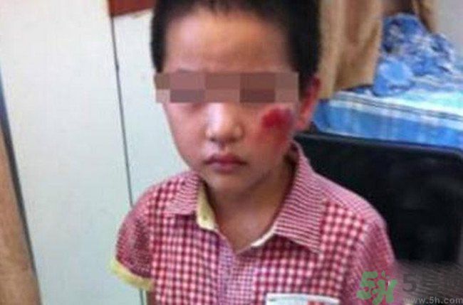 男孩遭校長暴打的結(jié)果是什么？男孩遭校長暴打的真相是什么？