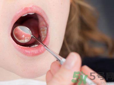 早上起床嘴苦是怎么回事？嘴苦怎么調(diào)理？