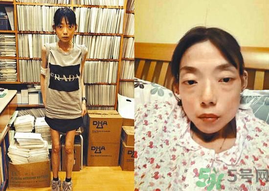 富二代離婚娶二線女星前妻瘦成骷髏  怎么選擇有責任的男人？