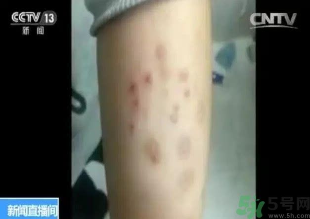 被污染學(xué)校是哪個？500師生患病的原因？