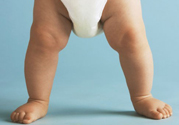 孩子一個腿長一個腿短是什么??？孩子長短腿怎么辦？