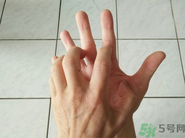 手上起水泡是什么原因？怎樣預(yù)防手上起水泡？