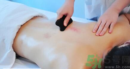 夏季刮痧好嗎？刮痧能治療什么疾?。? width=