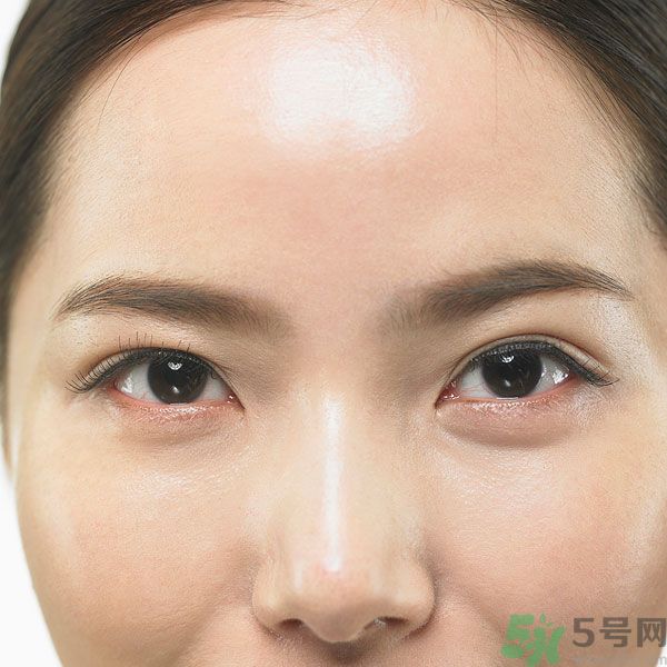 眉周紋是怎么形成的？眉周紋怎么去除？