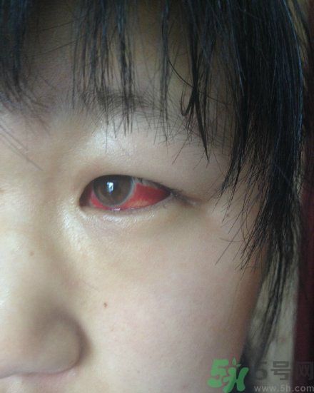 初中生全體甲醛中毒是怎么回事？初中生全體甲醛中毒是哪個(gè)學(xué)校？