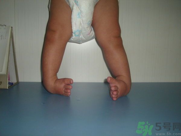 女生3天花8萬是怎么回事？馬蹄足是什么??？