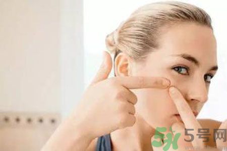 一到夏天呢長(zhǎng)痘痘怎么回事？夏天長(zhǎng)痘痘怎么辦？