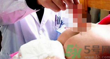 幼童屁股長(zhǎng)出尾巴的原因是什么？孕婦缺什么幼童屁股長(zhǎng)出尾巴？