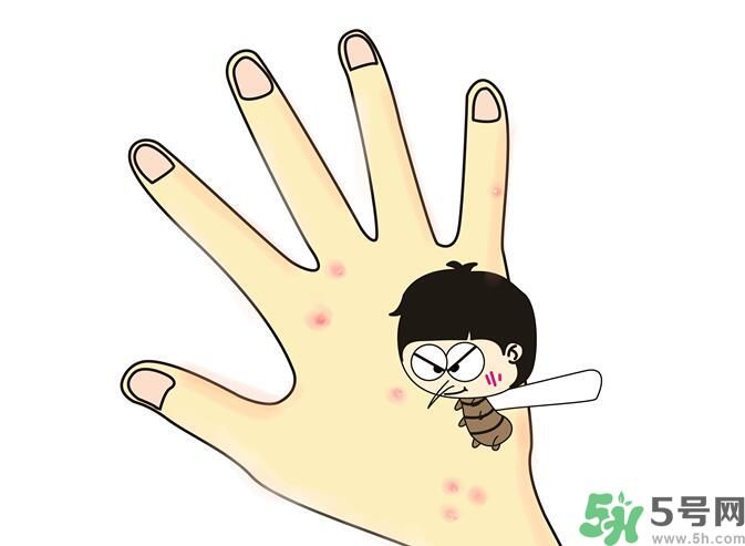 蚊子叮的包過幾天又癢是為什么？蚊子叮的包過幾天又癢怎么辦？