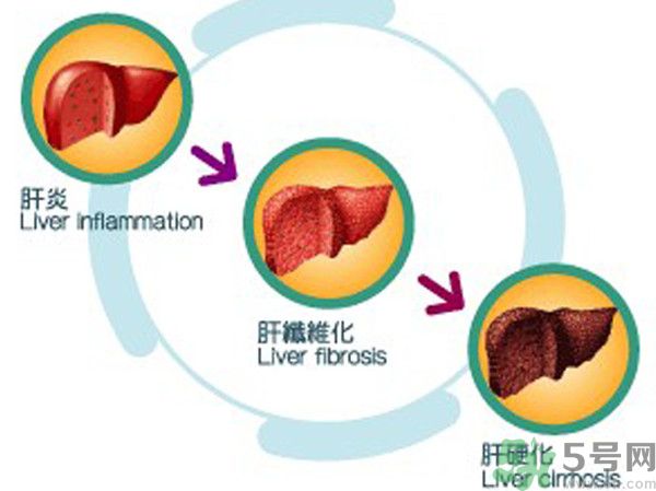在外面吃飯會(huì)得乙肝嗎？在食堂吃飯會(huì)得乙肝嗎？