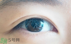 單眼皮怎么變雙眼皮了？單眼皮上面有一條線