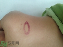 種草莓吻痕是什么意思？吻痕是怎么弄出來的？