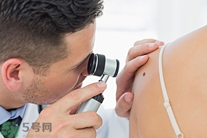 臉上長(zhǎng)痣是什么原因？臉上為什么會(huì)長(zhǎng)痣？