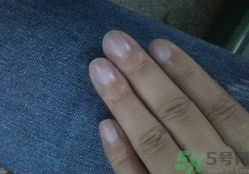 指甲發(fā)紫是什么原因？指甲發(fā)紫是怎么回事？