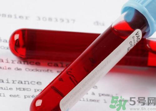 獻(xiàn)血后可以洗澡嗎？抽血后可以洗澡嗎？