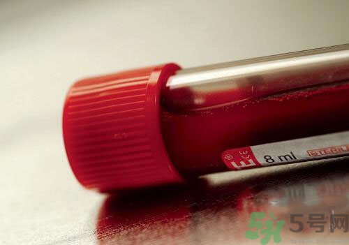 獻(xiàn)血后可以洗澡嗎？抽血后可以洗澡嗎？