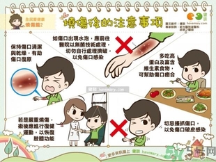 手被油燙傷了怎么處理？手被油燙起泡了怎么辦？