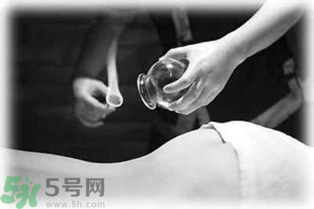 大暑可以拔罐嗎？大暑拔罐好不好？
