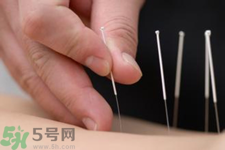 大暑可以針灸嗎？大暑針灸好不好？