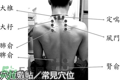 經(jīng)期可以貼三伏貼嗎？來月經(jīng)可以貼三伏貼嗎？