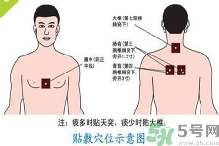 肝炎貼三伏貼有用嗎？肝病貼三伏貼貼哪里？