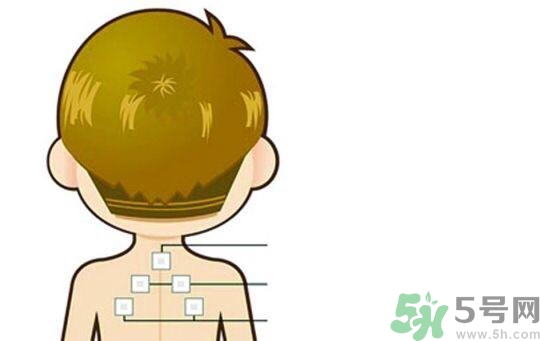 三伏貼可以去濕氣嗎？三伏貼去濕氣貼哪里？