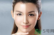 干性皮膚用什么洗面奶？干性皮膚該怎么保養(yǎng)？