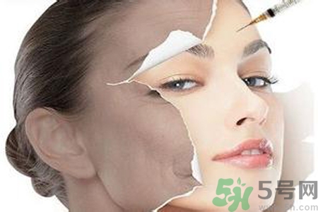 美白針效果怎么樣？美白針有副作用嗎？