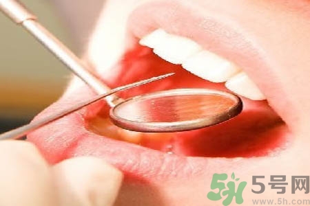 冷光美白牙齒是什么？冷光美白牙齒的好處有哪些？