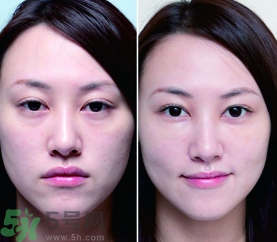 臥蠶是什么？臥蠶是眼袋嗎？