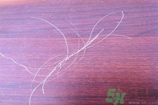 生完寶寶白頭發(fā)的原因？生完寶寶白頭發(fā)怎么辦？