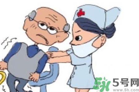 癲癇的典型癥狀有哪些？癲癇是什么？