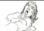 癲癇的發(fā)病因素？癲癇的并發(fā)癥有哪些？