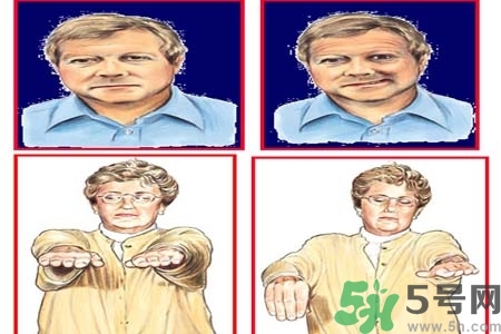 腦中風(fēng)是什么？腦中風(fēng)的癥狀？