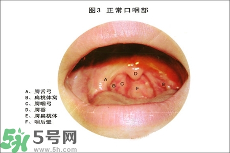 慢性咽炎的治療方法？慢性咽炎的藥物治療？