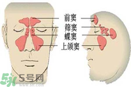 鼻竇炎是什么？鼻竇炎的癥狀有哪些？
