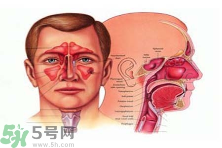 鼻竇炎是什么？鼻竇炎的癥狀有哪些？