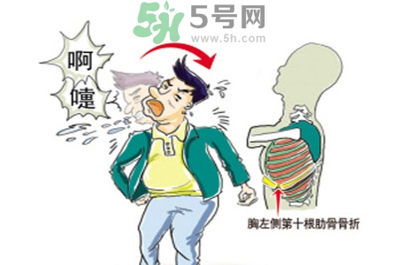 過(guò)敏性鼻炎是什么？過(guò)敏性鼻炎的癥狀有哪些？
