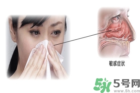 過敏性鼻炎的高發(fā)人群有哪些？如何預(yù)防過敏性鼻炎？