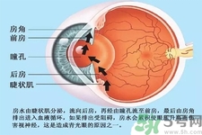 青光眼是什么？青光眼癥狀有什么？