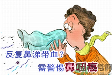 鼻咽癌是什么？鼻咽癌的癥狀有哪些？
