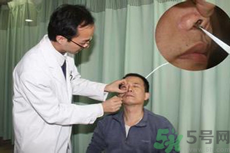 鼻咽癌的治療方法是什么？鼻咽癌可以用什么藥物治療？
