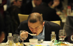 男人禿頂會(huì)遺傳嗎？男人禿頂是腎虛嗎？