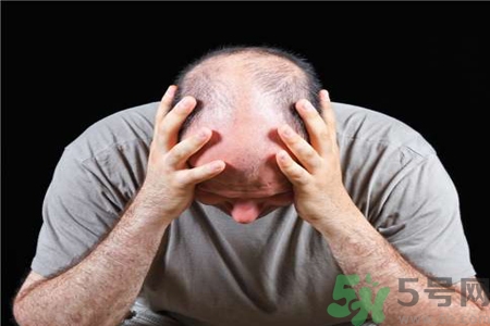 脫發(fā)的高發(fā)人群有哪些？如何預(yù)防脫發(fā)？