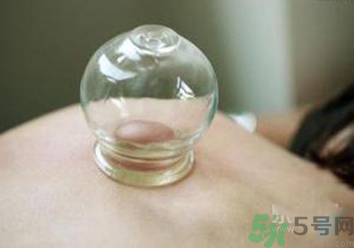 拔火罐和拔氣罐哪個好？拔火罐和拔氣罐的區(qū)別