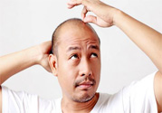 脫發(fā)的高發(fā)人群有哪些？如何預(yù)防脫發(fā)？